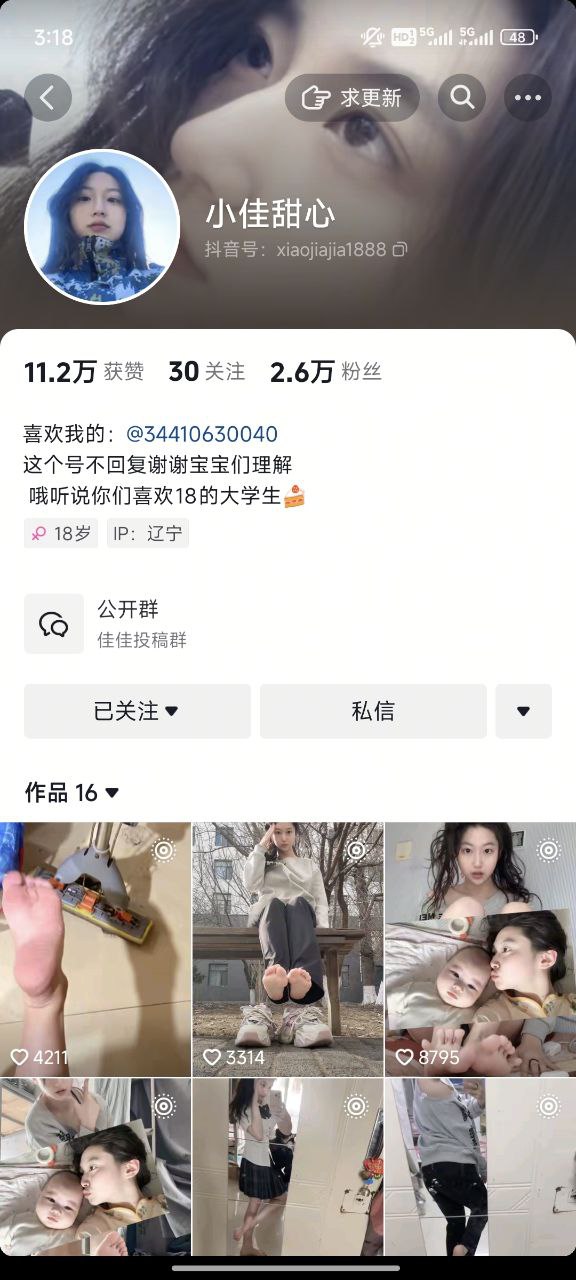 图片[7]-抖音博主女大学生小佳甜心定制福利[263P56V]-尤妹社